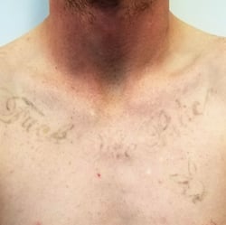 10. Dec 2018 Post 7 txt - Black Ink - Type II - Upper chest