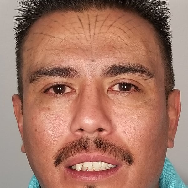 4. Nov 2018 Post 7 txt -Black Ink - Type IV - Cheeks and Forehead