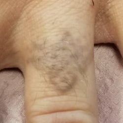 6. Nov 2017 Post 6 txt -Black Ink - Type III - Ring Finger