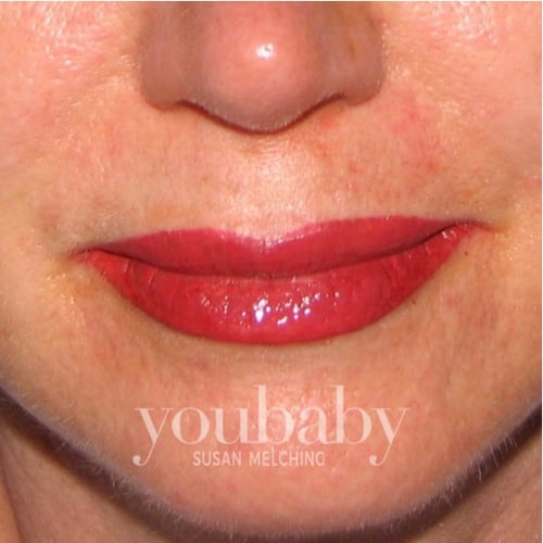 Lip Color Permanent Makeup Before & After in Denver | youbaby Skin Spa