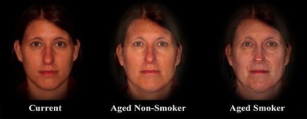 Smoker aging