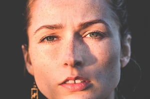 woman with freckles