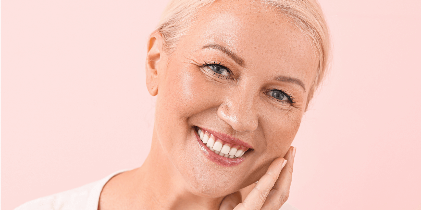 RF Microneedling model close up of smiling woman