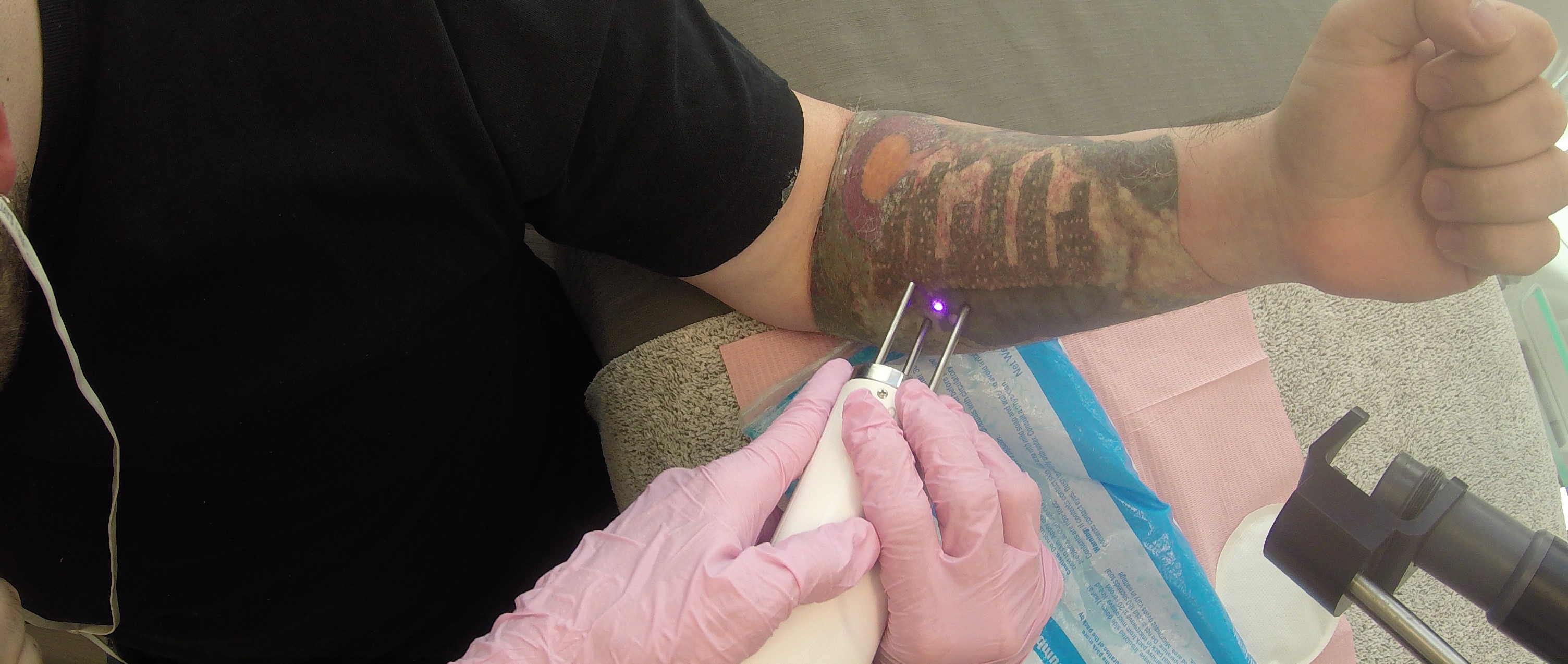 Hepatitis C linked to tattoo ink | Fox News