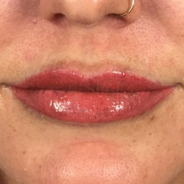 Lips-after-2-1