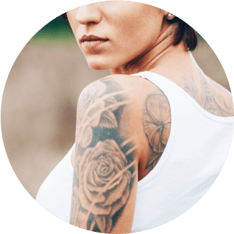 Picosure Fort Collins  Colorado Laser Tattoo Removal