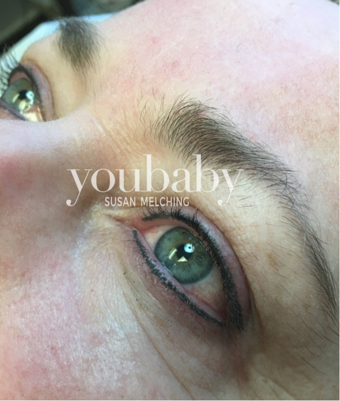 el lash enhancement2a