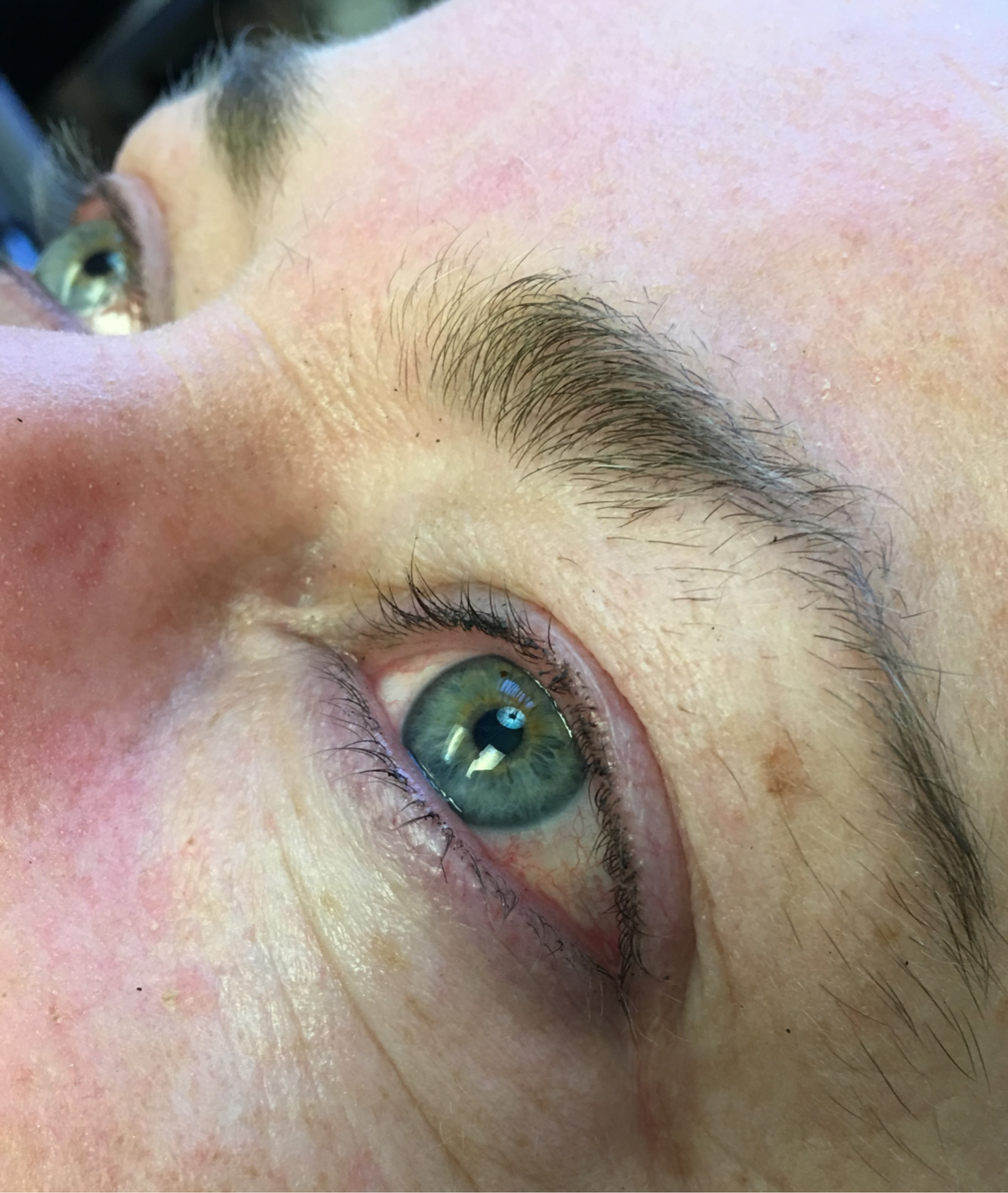 el lash enhancement2b