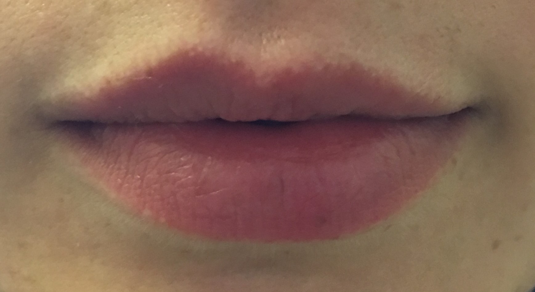 lips before cu