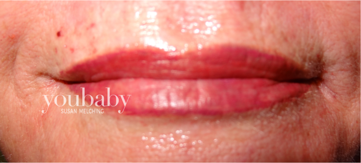 lips5a