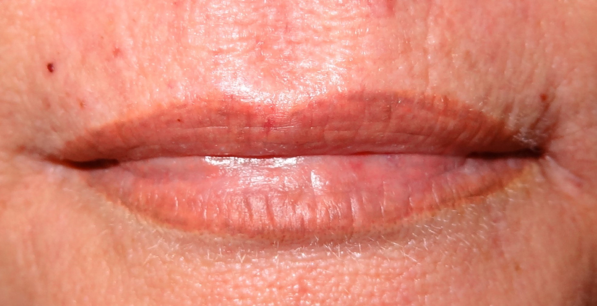 lips5b
